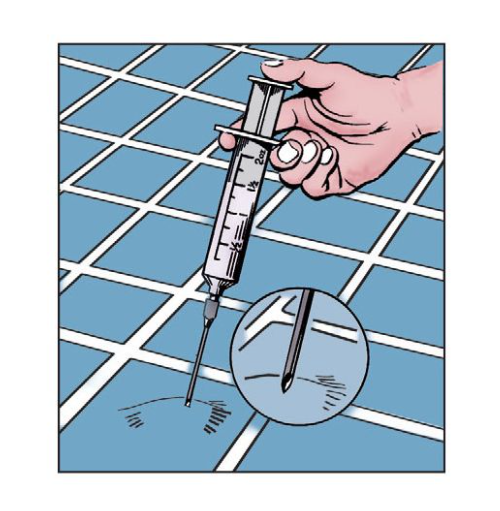 Adhesive Syringe